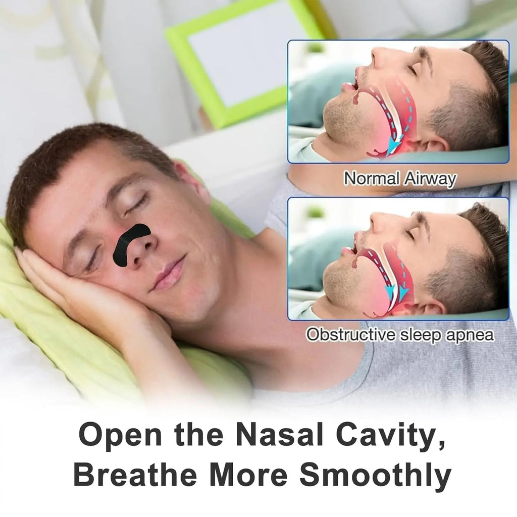 Nasal Breathing Strips (30pcs)
